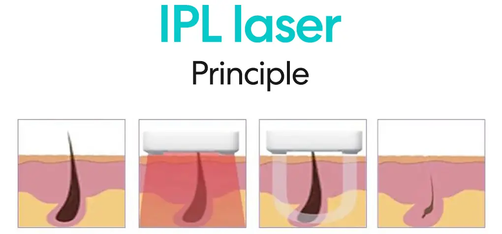 ipl principle