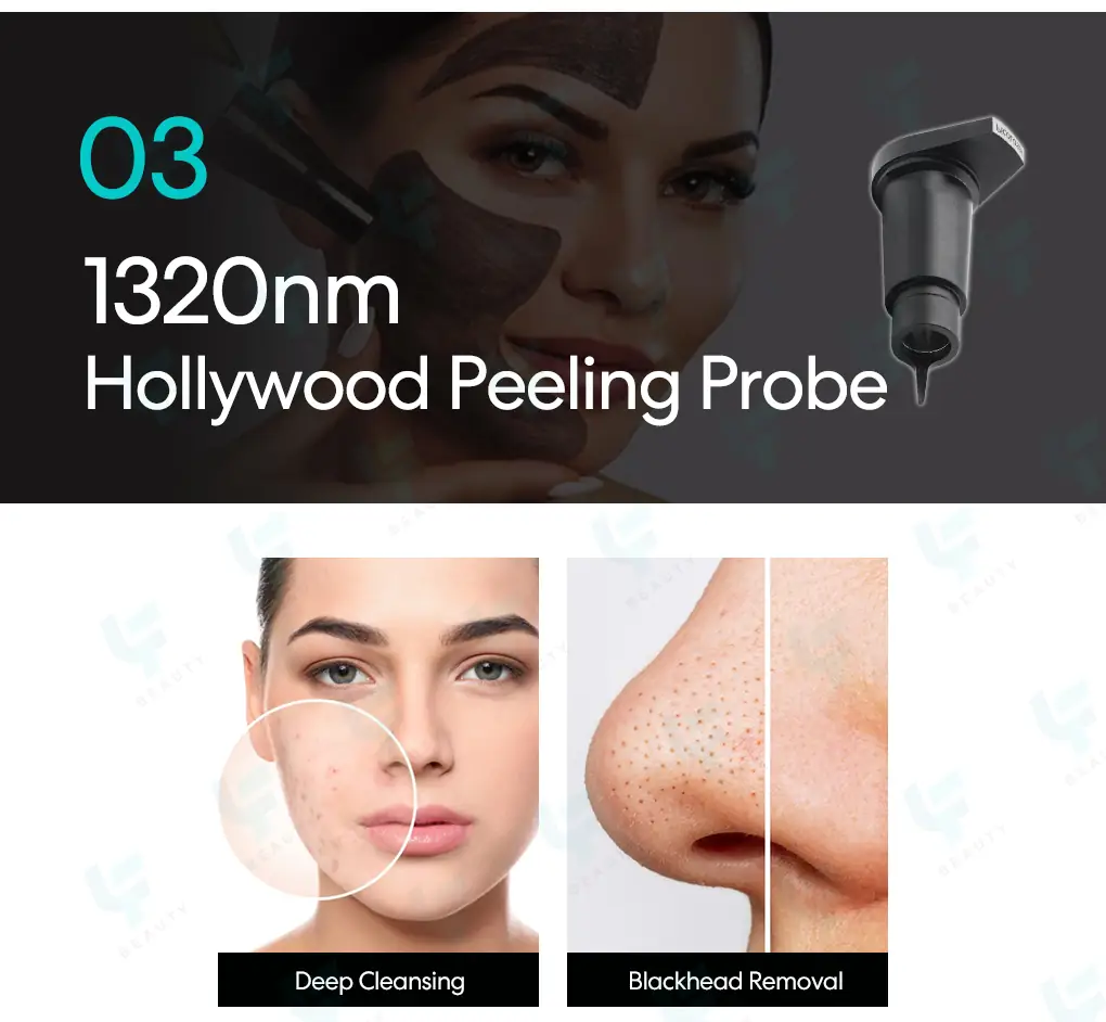 1320nm hollywood peeling probe