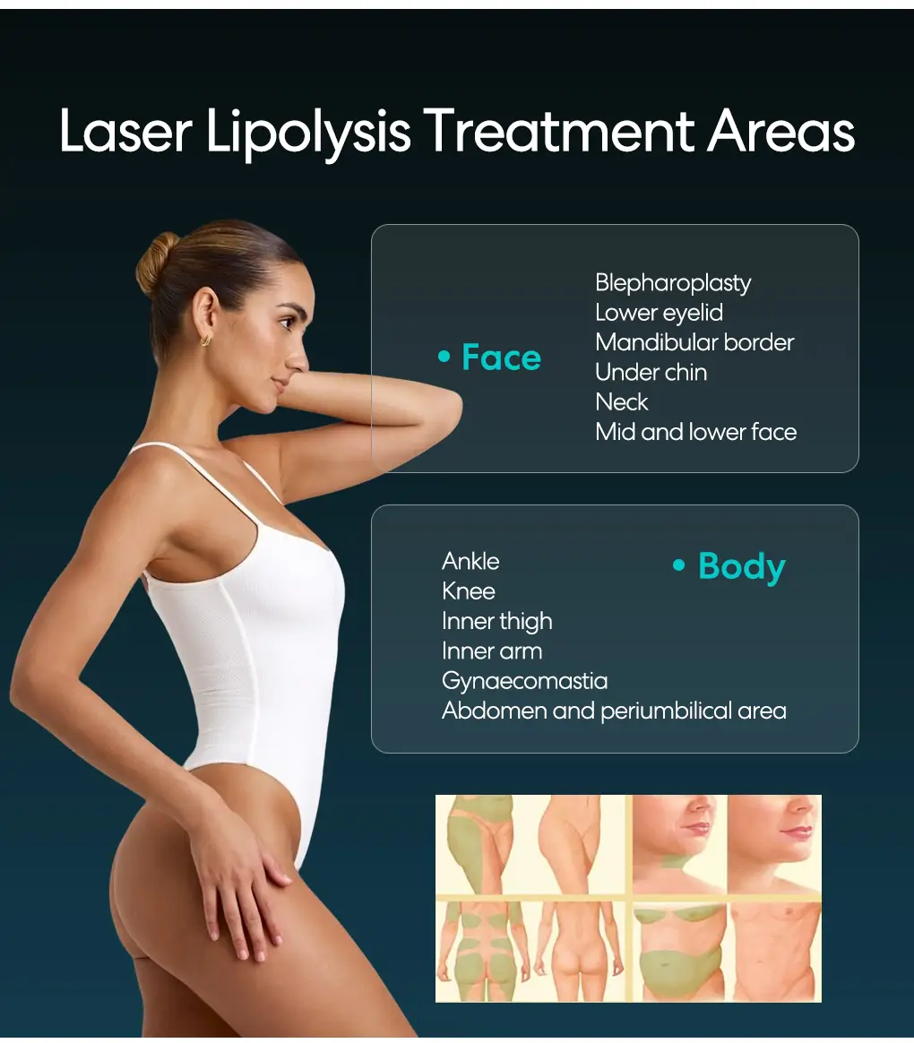 980nm 1470nm lipolysis diode laser treatment areas