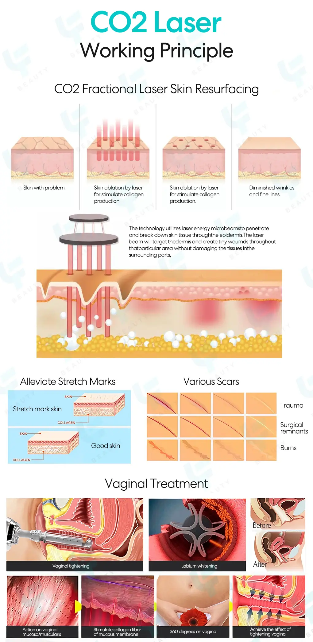 co2 fractional laser principle
