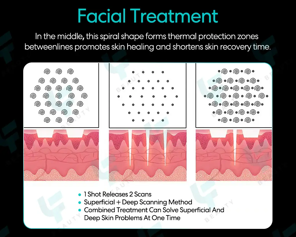 technological advantages (2)