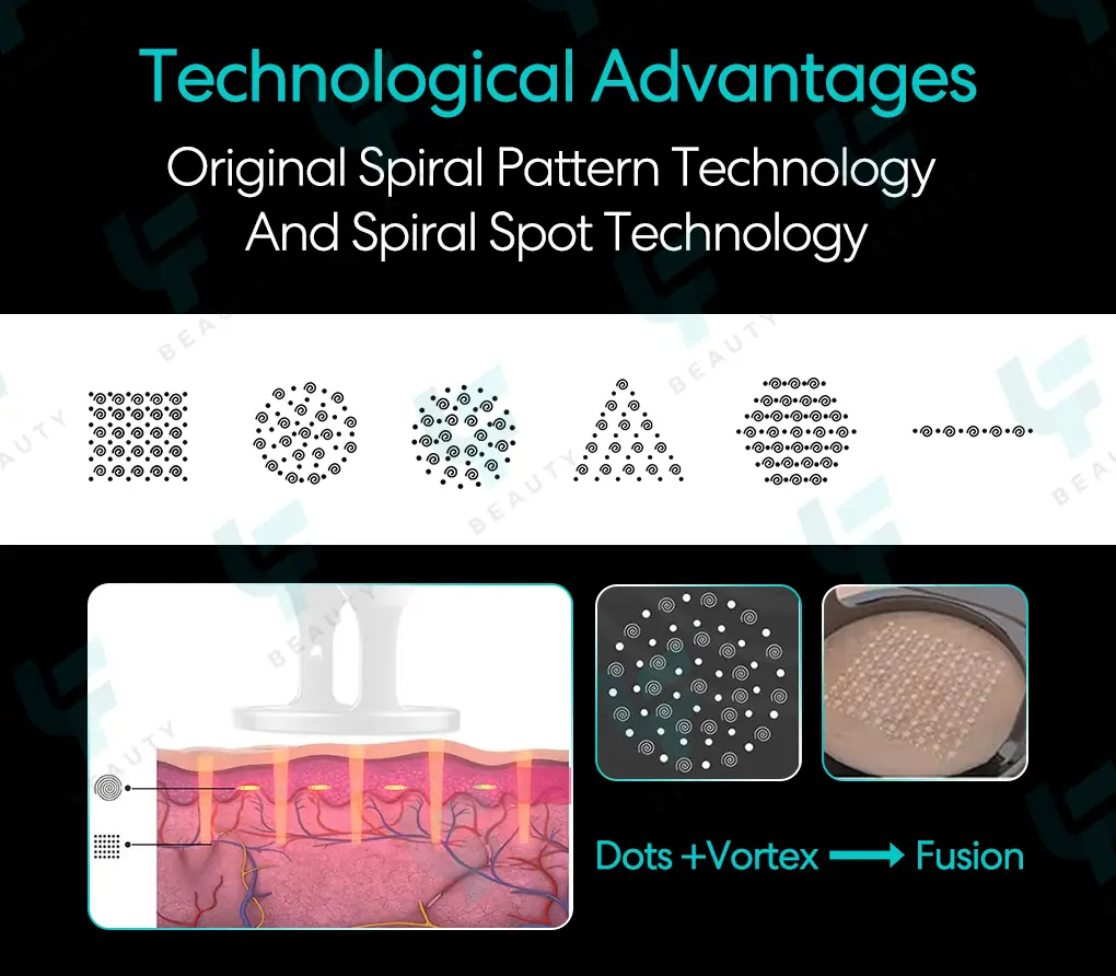 technological advantages