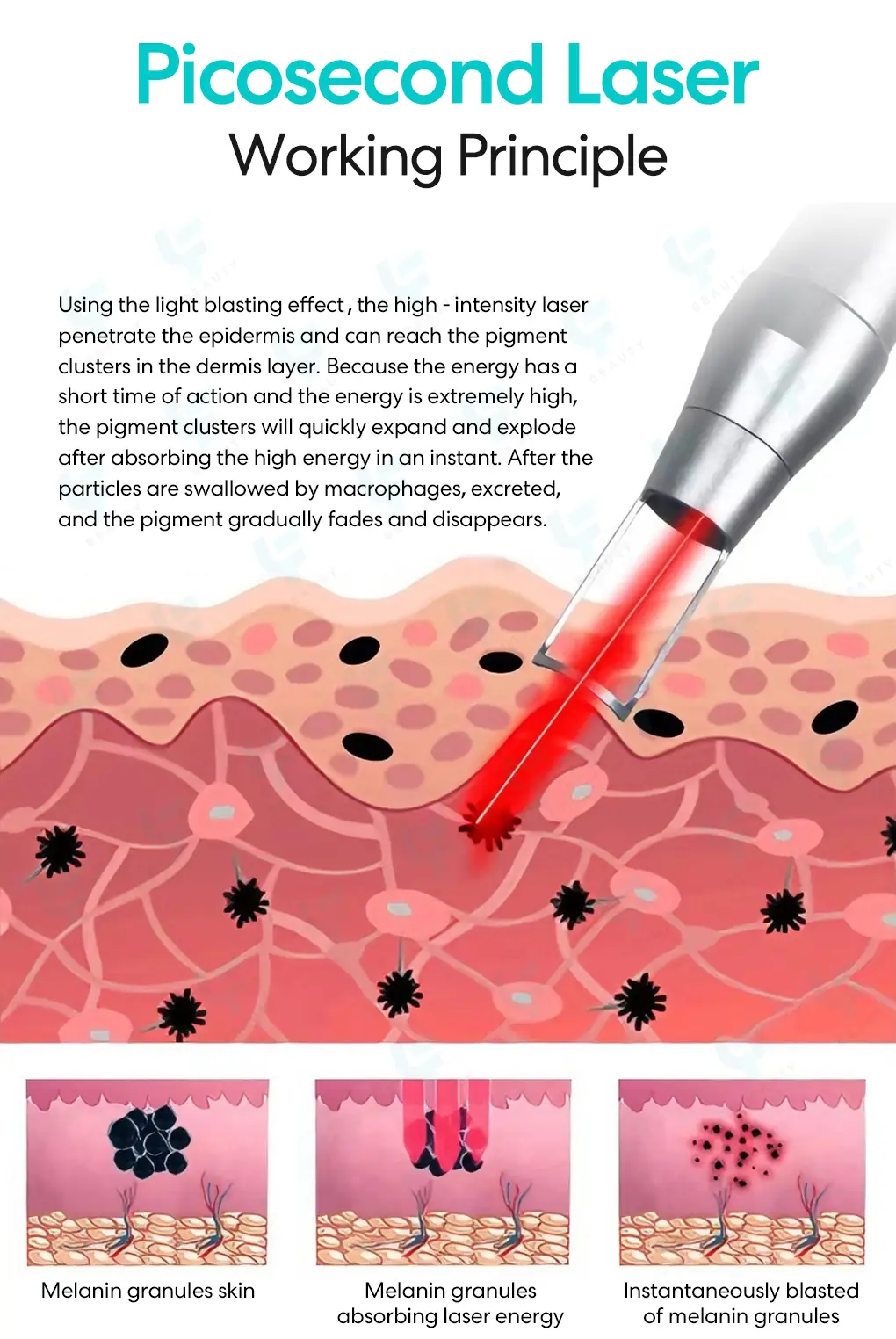 picosecond laser working principle