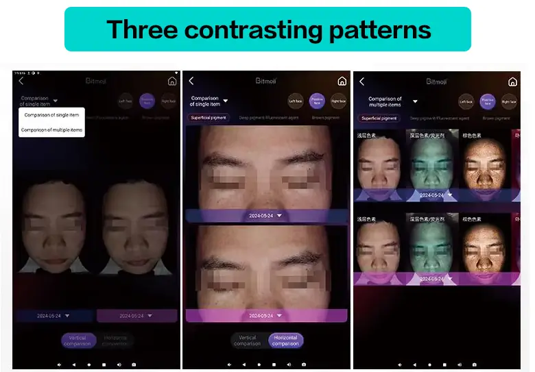 3 contrasting patterns