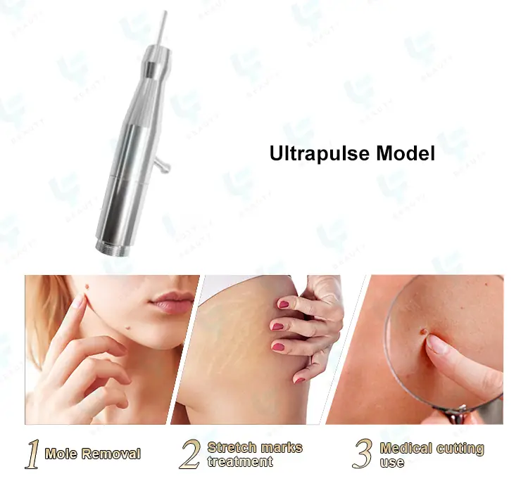 ultrapulse model