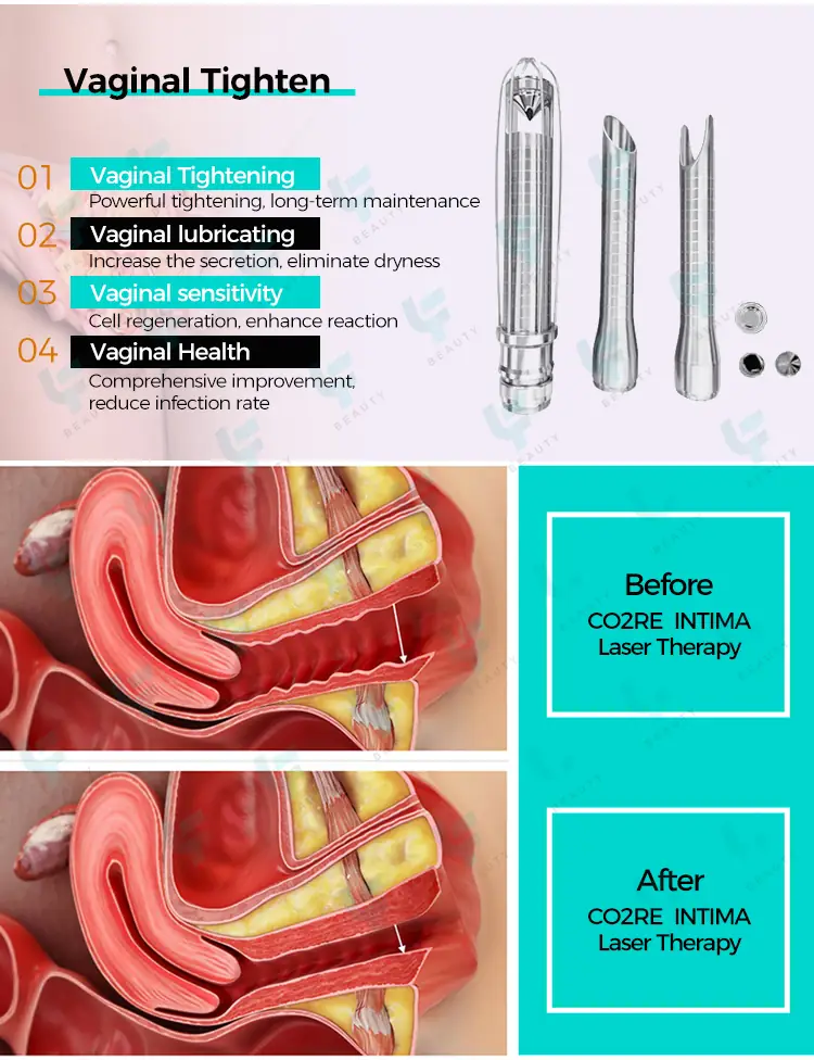 vaginal tighten head