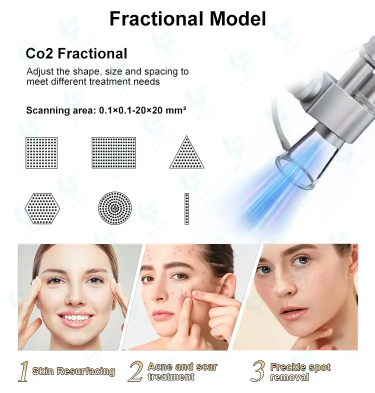 fractional model