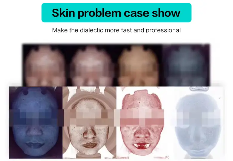 skin problem case show