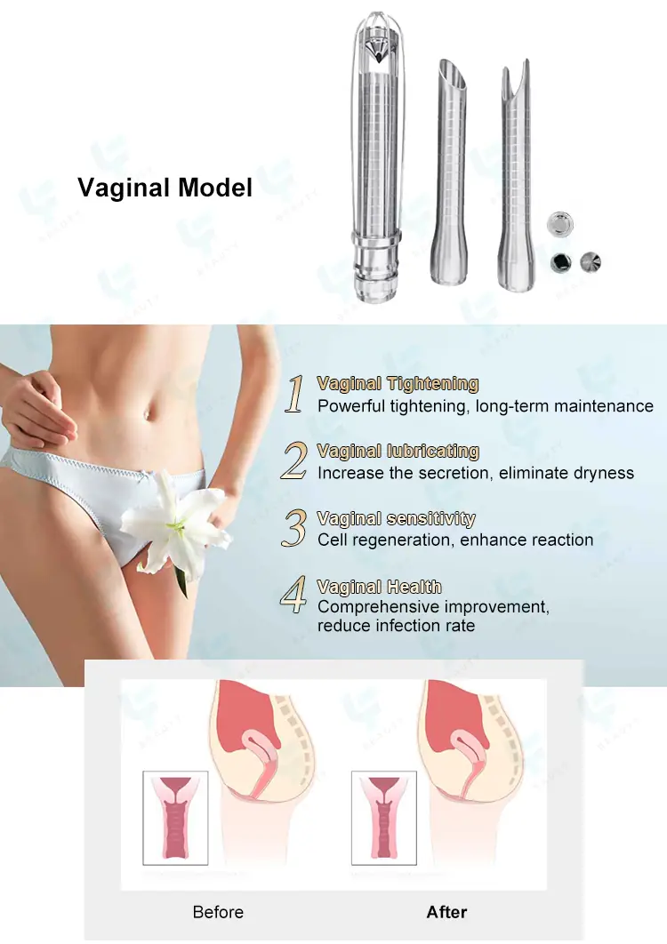 vaginal mode