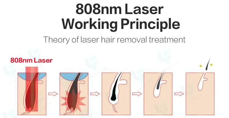 808nm diode laser working principle
