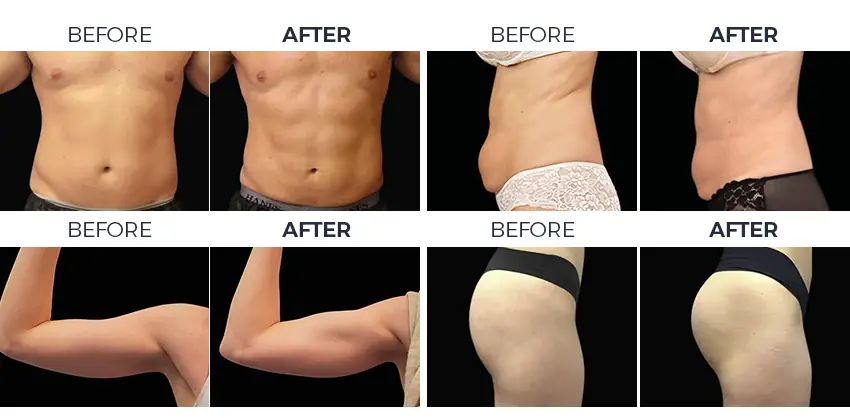 before and after treatment