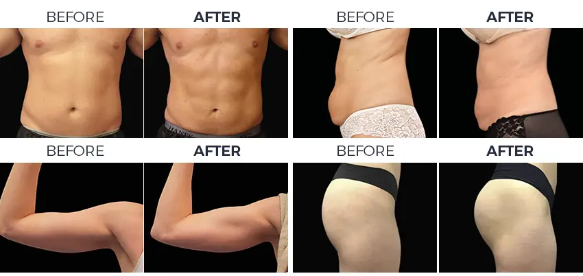 before and after