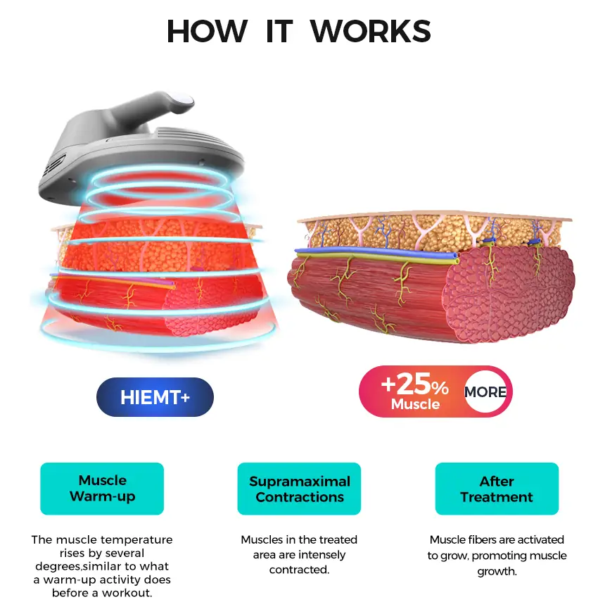 working principle