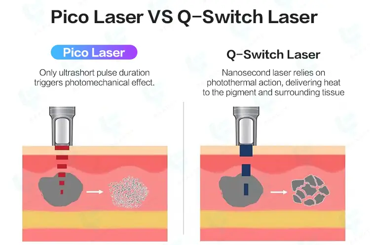 pico laser vs q switched laser
