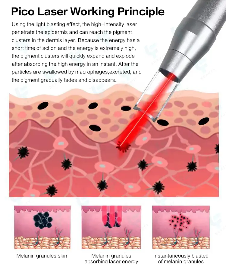 pico laser working principle