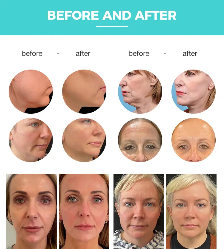 before and after