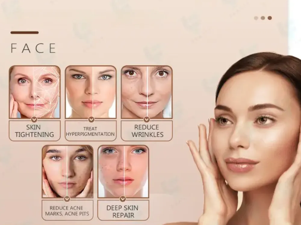 what rf microneedling training should establish